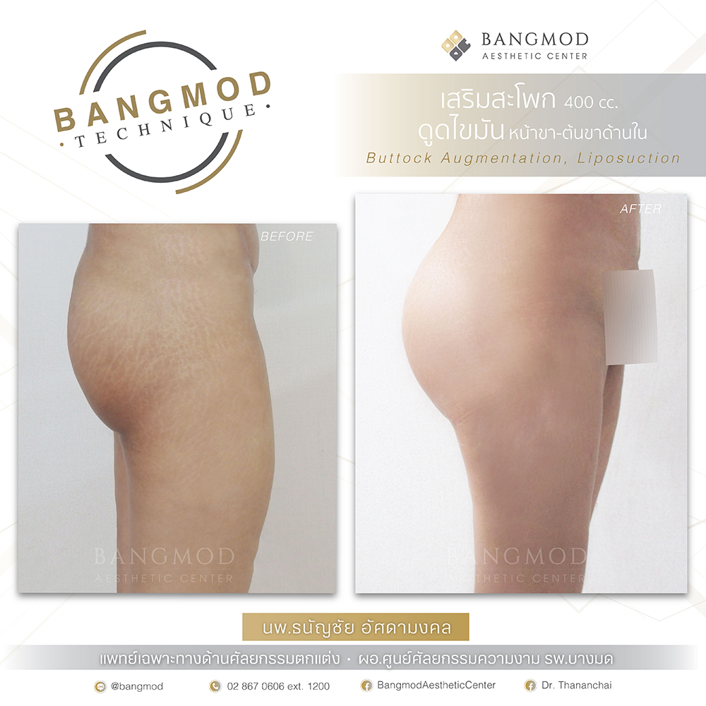 Sgarlet กางเกงในไซส์ใหญ่เอวสูง กระชับหน้าท้อง สีดำ/เนื้อ MB6002 – Sgarlet  Plus Size, image size:1000x1000